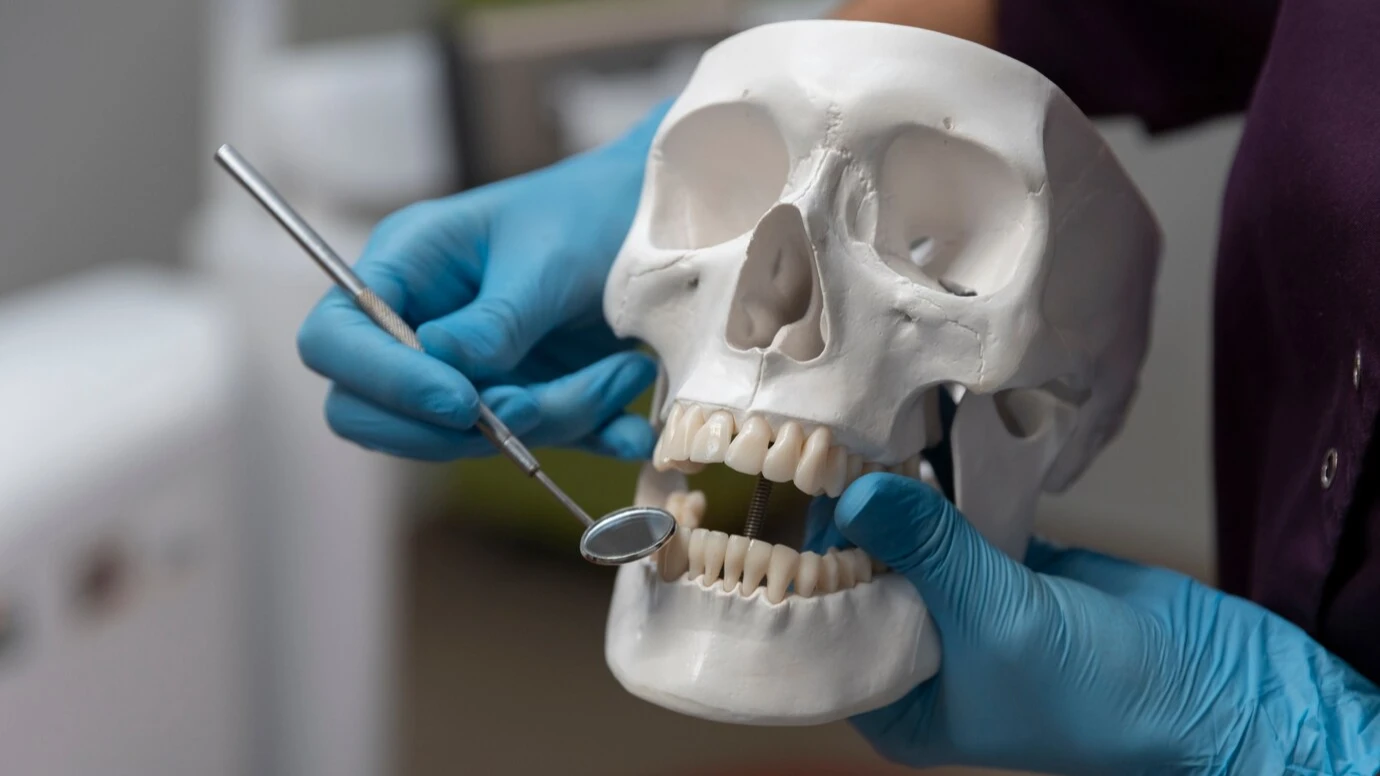 Zygomatik İmplantlar vs. Geleneksel İmplantlar: Hangisi Daha İyi?